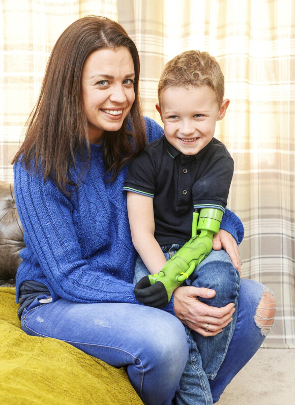 STOLT MAMMA: Gemma er imponert over hvor raskt hennes lille gutt har vent seg til robot-armen. Foto: NTB Scanpix STOLT MAMMA: Gemma er imponert over hvor raskt hennes lille gutt har vent seg til robot-armen. Foto: NTB Scanpix